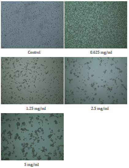 Figure 2: Microscopic image after quantitative assay on HeLa cell line.
