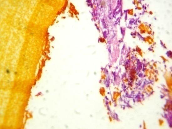 Figure 14
