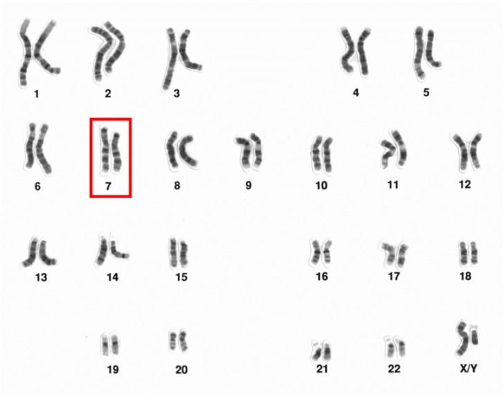 Figure 3: Schematic of Normal Human Male Chromosomal Karyotype [1].