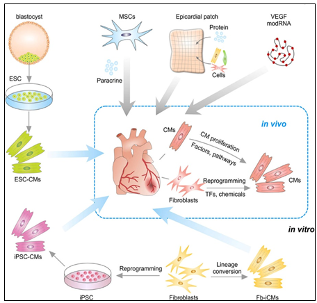 Figure 8: Strategies for treating cardiac repair and regeneration.