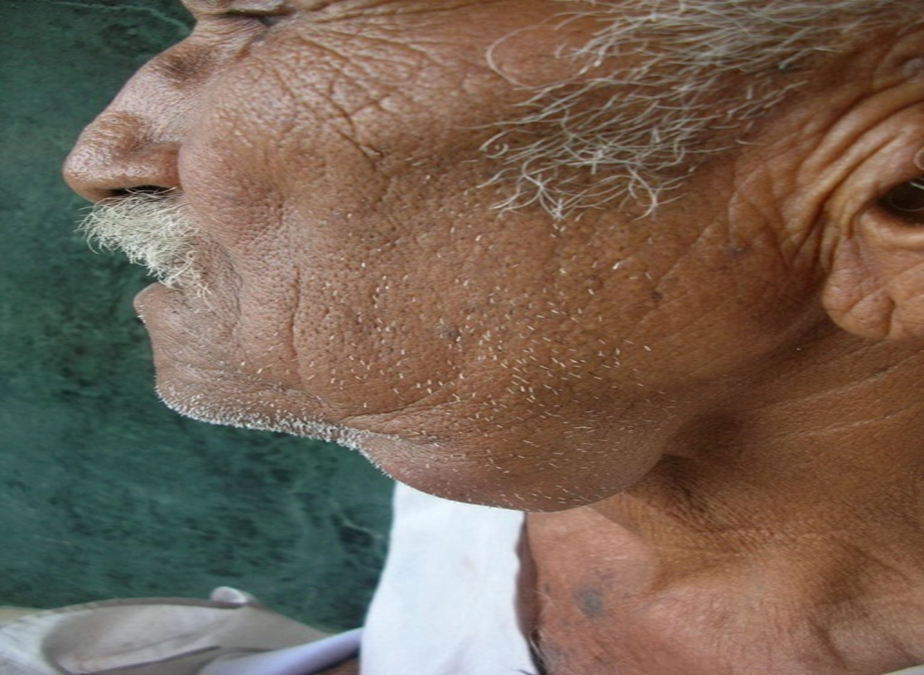 Figure 1: Dimensions of Swelling.