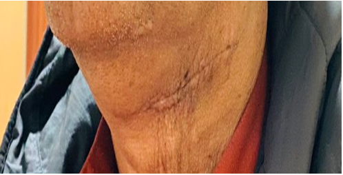 Figure 9: Post-Op Wound Status.