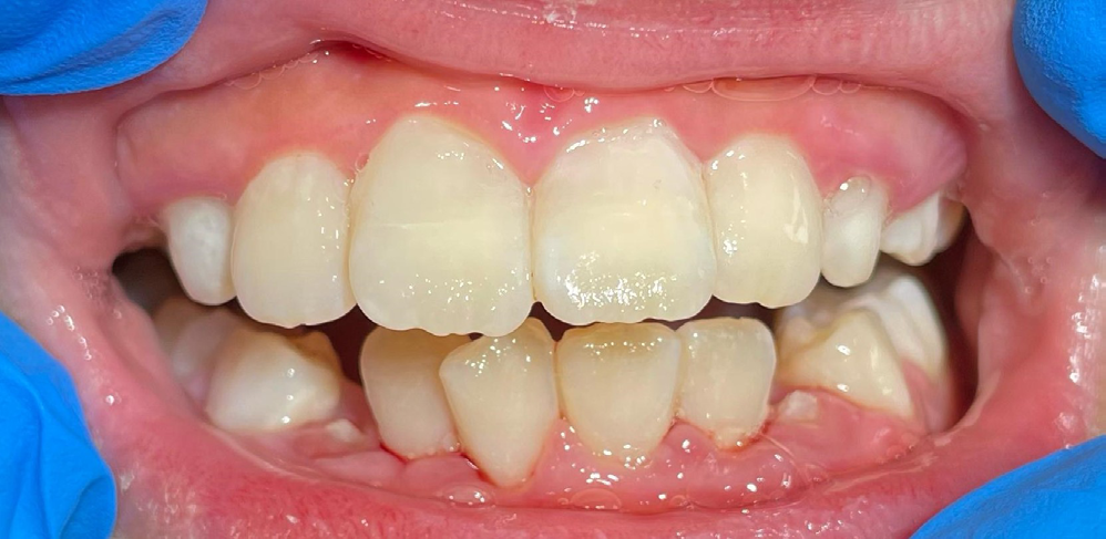 Figure 6: Post-operative view.
