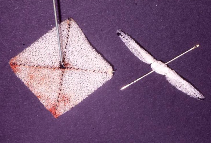 Figure 1: Photograph of the original buttoned device. Reproduced from Rao PS [12].