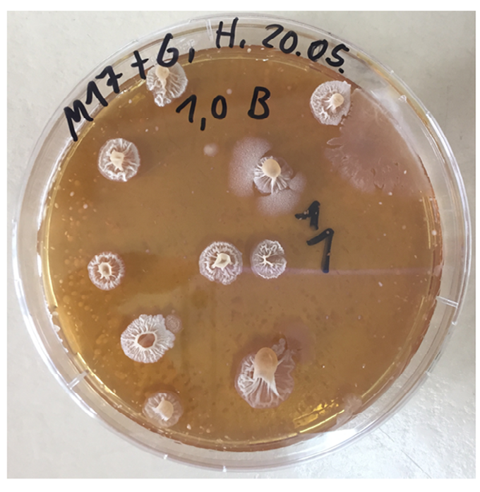 Figure 3: Microscopic image of colonies from M17 agar-Sporeformers as observed under phase contrast microscope (Axioskop 40 model).