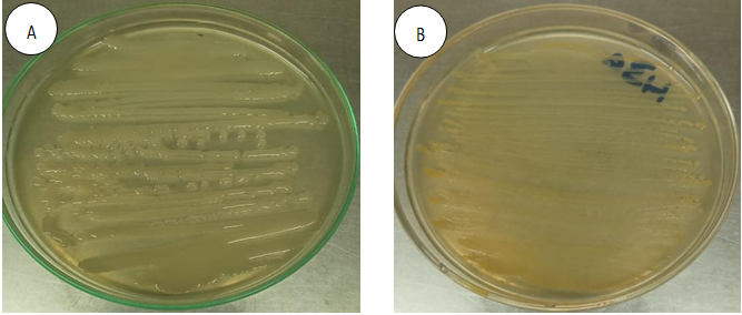 Figure 16: (A) Enterobacter on Nutrient Agar and (B) Staphylococcus aureus on Nutrient Agar.