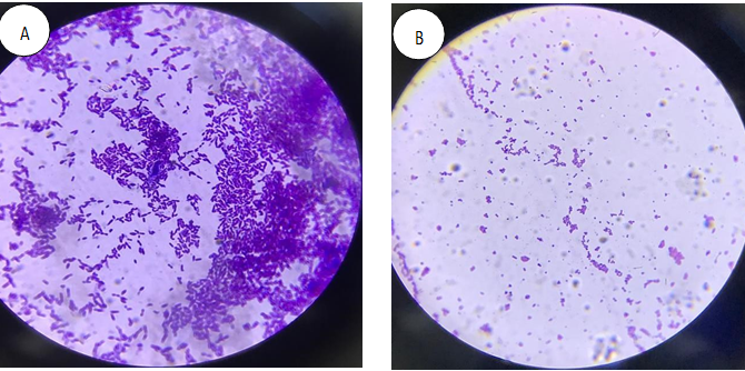 Figure 18: (A) Gram Positive Lactobacilli under Microscope and (B) Gram Positive Staphylococcus aureus under Microscope.