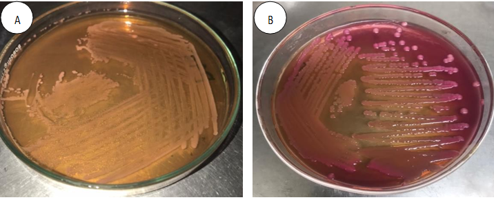 Figure 21: Identification of Pseudomonas aeruginosa and Escherichia coli by using MacConkey Agar (A) Pseudomonas aeruginosa isolated from an oral patient’s sample, (B) Escherichia coli isolated from oral patient’s sample.