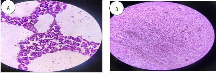 Figure 22: (A) Gram Positive Corynebacterium Rods under Microscope and (B) Gram Negative Escherichia coli Rods under Microscope.
