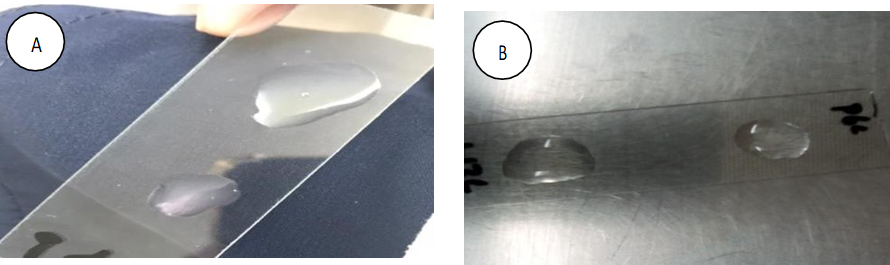 Figure 24: (A) Negative Coagulase Test for Streptococcus viridans, (B) Negative Catalase Test for Lactobacilli.