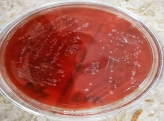 Figure 8: Gamma Hemolysis.