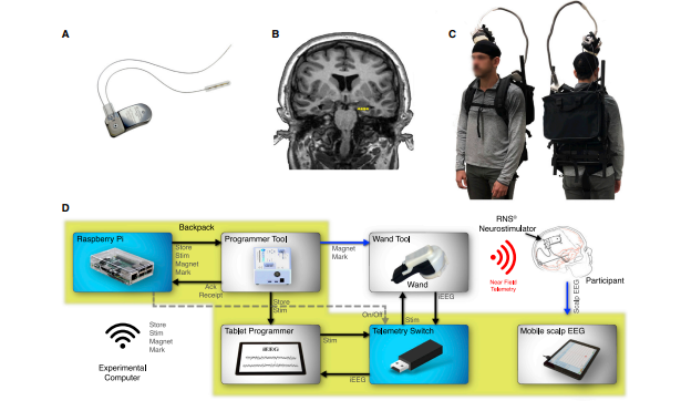 Figure 13: Brain Back Pack [34].