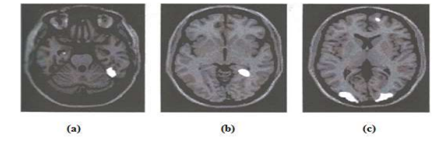 Figure 3: Regions in the Brain Stimulated by a) Portrait b) Landscape c) Still Life [9].
