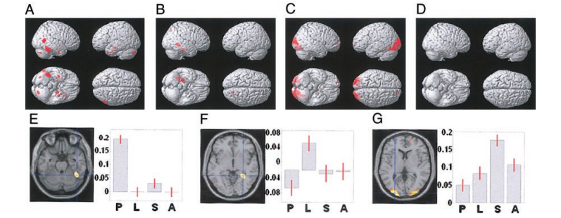 Figure 6: f- Stimulation Points Imaged with MRI [18].
