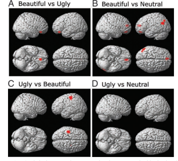 Figure 7: f- Stimulation Points Imaged with MRI [19].