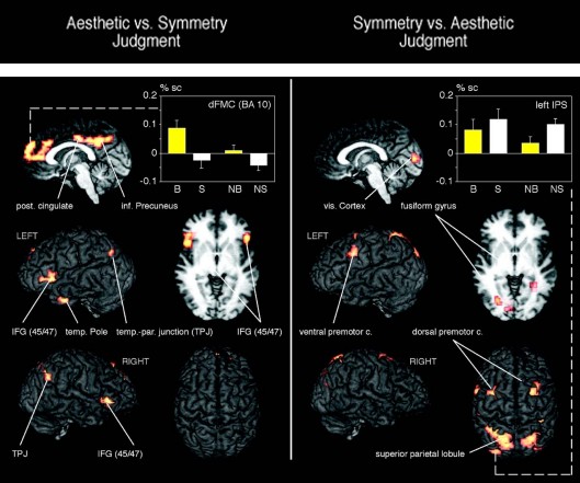 Figure 9: Brain Connections of Experimental Tasks [23].
