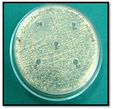 Figure 5: Antifungal Screening of Cream.