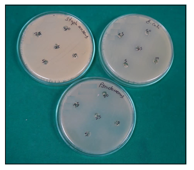 Figure 6: Antibacterial Screening of Cream.