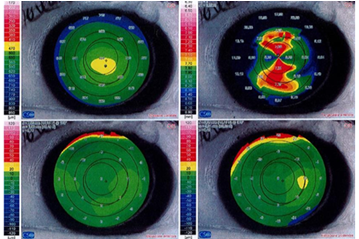 Figure 2: LE first topography.