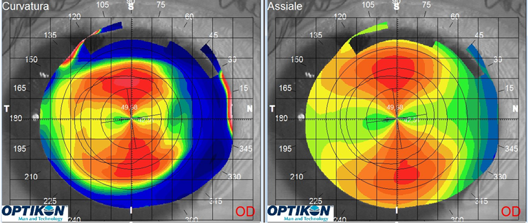 Figure 3: RE second topography.