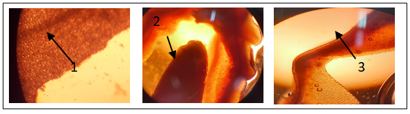 Figure 2: Transvers, longitudinal and surface sections of BBFs22. 1: Upper epidermis (Exocarp); 2: Seed; 3: Paranchymatous tissue.