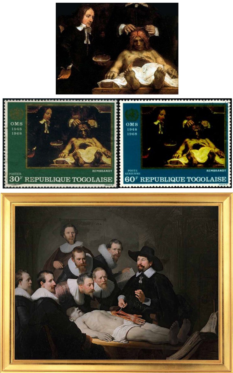 Figure 2: Rembrandt’s painting “Dr. Deimann’s Anatomy Lesson”.
