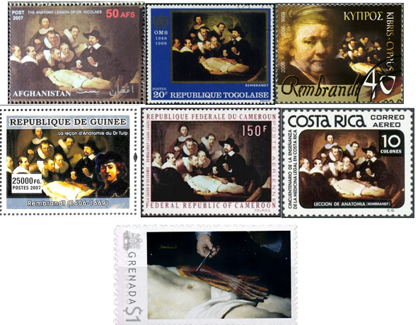 Figure 4: Copy of Rembrandt’s painting “The Anatomy Lesson of Dr. Nicolaes Tulp” on filately.