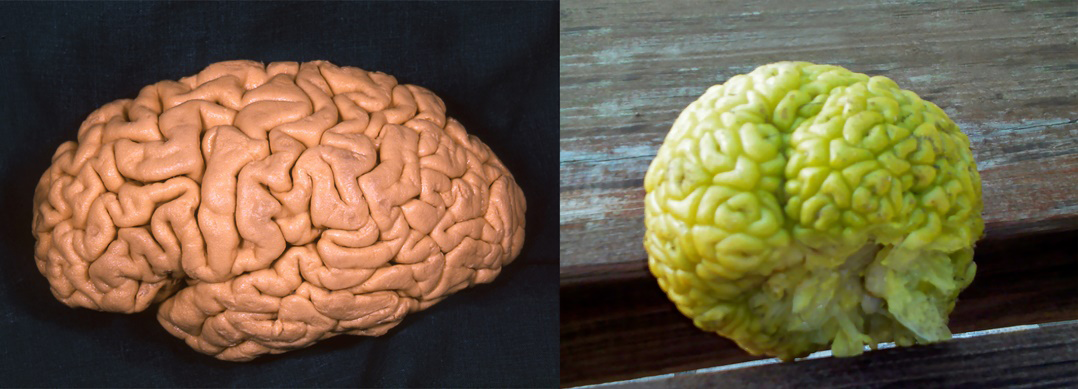 Figure 1: Cerebral gyri of a dissected hemisphere in a lateral view (left), and convolutions of the rhubarb bud (right) (Photo: S. Marinković).