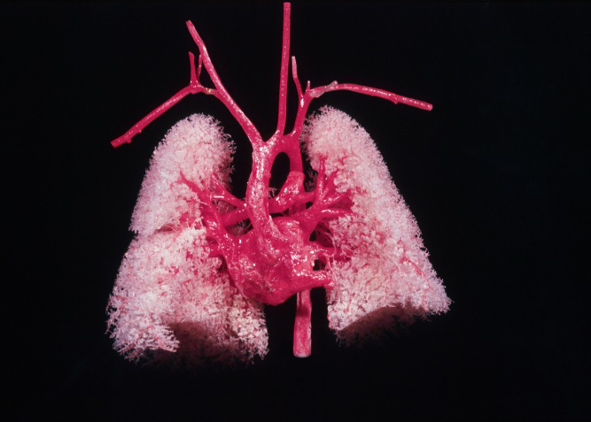 Figure 3: Anterior view of the vascular cast of the fetal lungs, heart and large arteries.