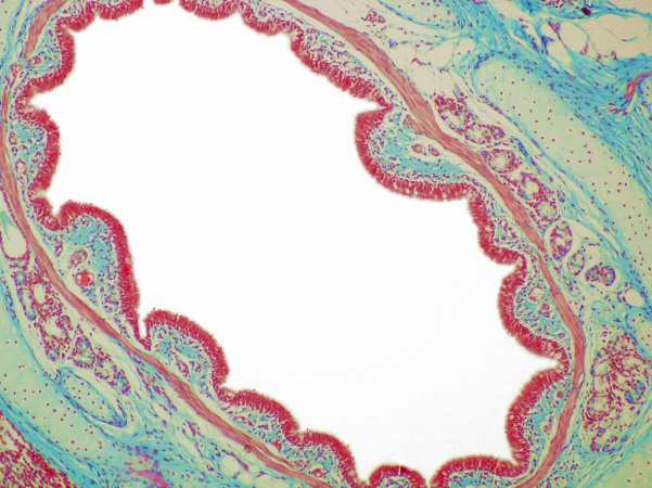 Figure 4: Micrograph of a transversely sectioned intrapulmonal bronchus (Masson staining, × 40).