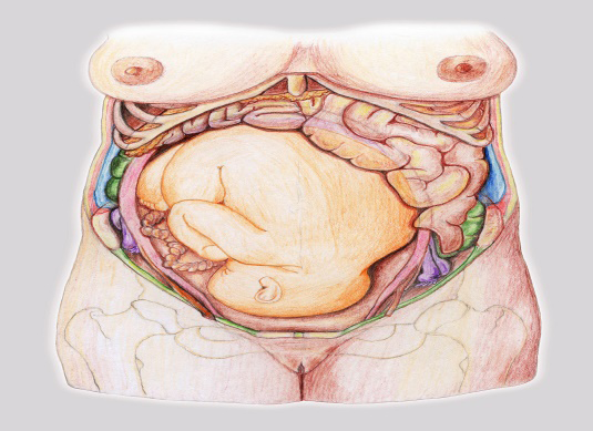 Figure 8: A drawing of a pregnant woman following an opening of the abdominal cavity and a coronal section of the uterus wall. (Modified by S. Marinković after Pernkopf [10]).
