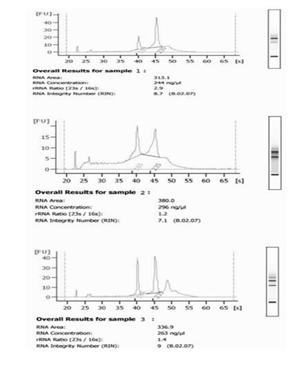 Figure 1: RNA was isolated from replicating phase (sample 1), extended stationary phase (ESP; sample 2) and resuscitation phase (RSP; sample 3) cells of _M. bovis_ BCG. RNA integrity was checked by Bioanalyzer 2100 (Agilent Technologies, U.S.A.).