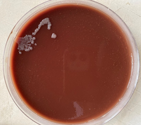 Figure 2: Stapylococcus aureus growth on chocolate agar plate.