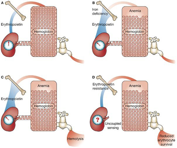 Figure 2: Daibetes is related to Anaemia [7].