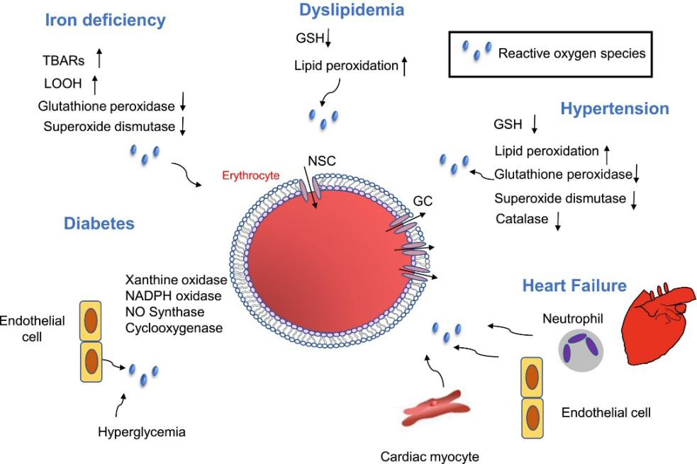 Figure 6: Erythropoietic stress caused by modifications in diabetes mellitus [25].