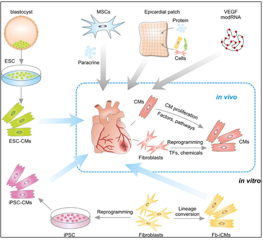 Figure 3: Strategies for treating cardiac repair and regeneration Transplantation of embryonic stem cell (ESC) derived CMs or iPSC derived CMs into myocardial infarction heart. CMs could also be reprogrammed from Fb in vitro or by transcriptional factors (TFs) or chemicals in vivo. Transplantation of MSCs promotes neovascularization and cardiomyocyte survival through paracrine mechanism. Epicardial patch containing growth factors or cardiac cells restores heart function after myocardial infarction. Administration of modified RNA (modRNA) of paracrine factors promotes heart function and drives heart progenitor cell fate. CMs could be promoted to proliferation by regulation of factors or signaling pathways.
