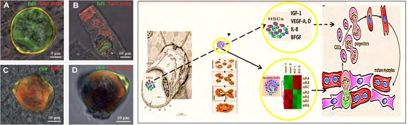 Figure 5: Hypothesis of pathogenesis of restoration of myocardial integrity after injury involving apoptotic bodies of cardiomyocytes (ApBc), resident myocardial stem cells (CSCs), and mesenchymal bone marrow stem cells (HSCs).