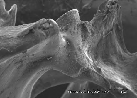 Figure 10: Sacrum (dorsal right view) (civil case sample) at 10 kV 40X magnification.