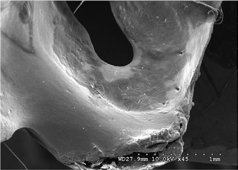 Figure 14: Dorsal view of stage 2 weathering (fissures and foramen shown) on anterior sacral depression (civil case sample) at 10 kV 45X magnification.