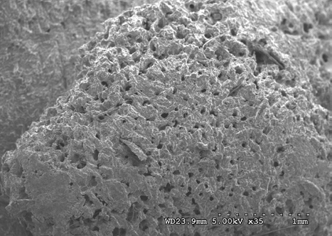 Figure 18: Medial sacral crest (heat and chemical dried sample) at 5 kV 35X magnification.