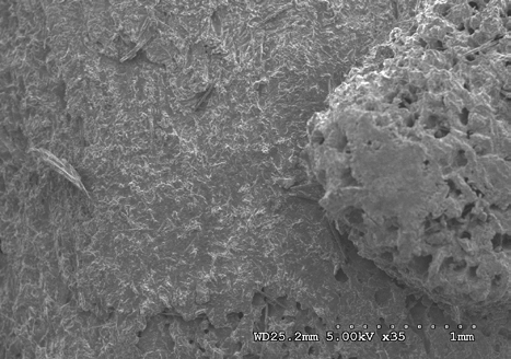 Figure 19: Medial sacral crest (heat and chemical dried sample) at 5 kV 35X magnification.