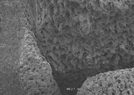 Figure 20: Sacrum (heat and chemical dried sample) at 10 kV 30X magnification.