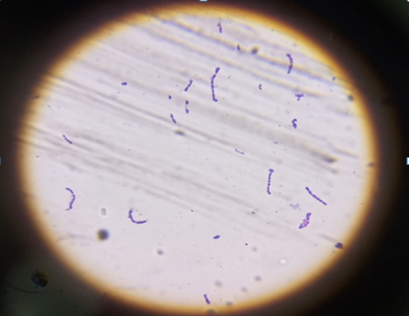 Figure 11: Negative Catalase test result of _S. pneumoniae_.