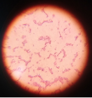 Figure 12: Gram staining and microscopy of Kleibsella spp.