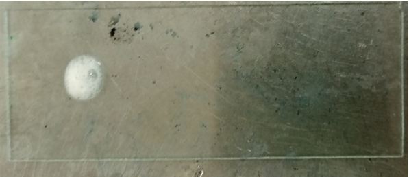 Figure 14: Gram staining and microscopy of _E. coli_ on the media.