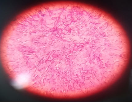 Figure 15: Positive Catalase test result of _E.coli_.