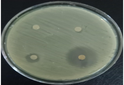 Figure 17: Antibiotic susceptibility test of _E. coli_ showed that it is intermediate to Cefotaxime and resistant to Ceftriaxone and Azithromycin.