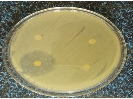 Figure 18: Antibiotic susceptibility test of Klebsiella showed that it is resistant to Cefotaxime and resistant to Ceftriaxone and Azithromycin.