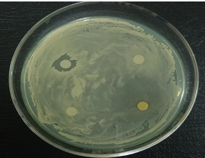 Figure 19: Antibiotic susceptibility test of _S. aureus_ showed resistant to all antibiotics used.