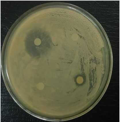 Figure 20: Antibiotic susceptibility test of _S. pneumoniae_ showed that it is resistant to all antibiotics used.